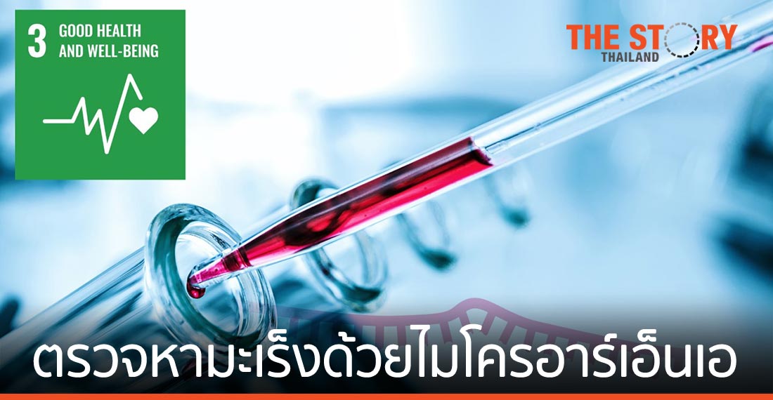 ตรวจหามะเร็ง 13 ชนิด ด้วยเทคโนโลยีไมโครอาร์เอ็นเอ